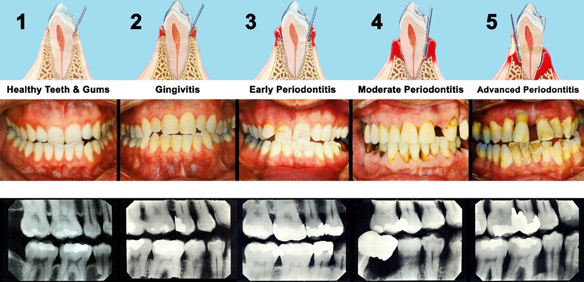 cosrx refresh aha bha vitamin c lip plumper Buccal mucosa melanoacanthoma: a case report and debate about its clinical  concern main image 1